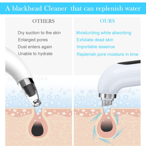 Deep Skin Cleanse with Small Bubble Technology Blackhead Remover USB Rechargeable